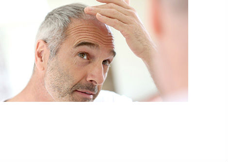 تساقط الشعر المرتبط بمرض السكري: الأسباب وطرق التعامل