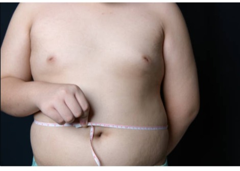 زيادة الوزن لدى البالغين تشكل عامل خطر لجلطات الدم عندهم كشباب