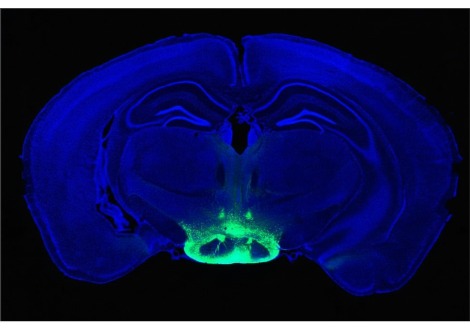تم تحديد الخلايا الأكثر عرضة لمرض الزهايمر