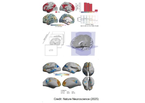 رسم خريطة لشبكة الوضع الافتراضي في الدماغ البشري: دراسة تشريحية تشير إلى أن لها تأثيرًا واسع النطاق