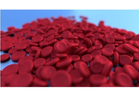 يصيب فقر الدم ربع سكان العالم ولكن هناك طرق لتفاديه  